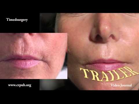 Irina pacco di faccia bianco Produttore di liqiuskin di crema