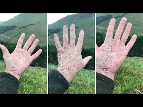 Giant Swarm Of Midges Stick To Hand In Scotland