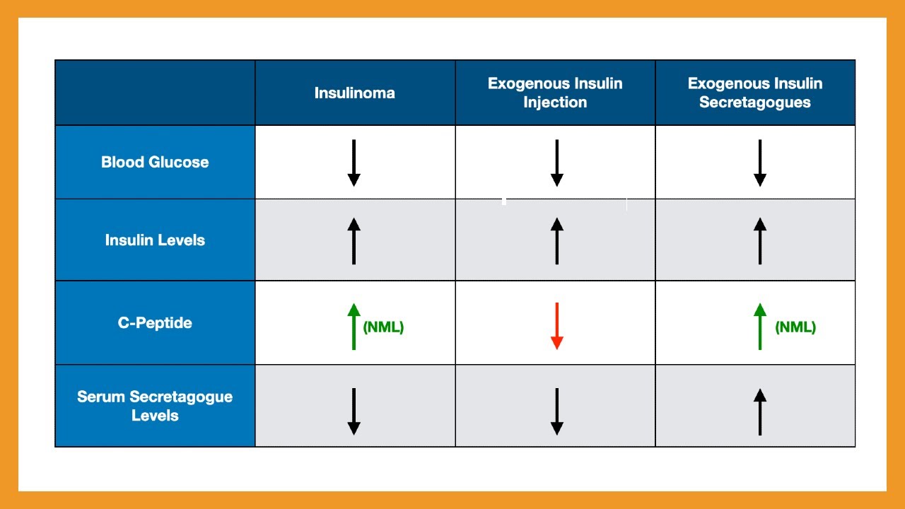 Insulinoma vs. Factitious Hypoglycemia