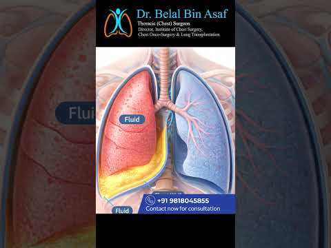 Pleural Effusion Kya Hota Hai? | #medical #shorts #pleuraleffusion