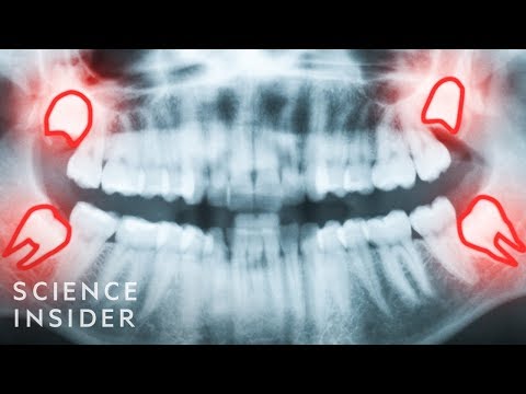 進化的6種方式讓我們陷入困境 (6 Ways Evolution Screwed Us Over)