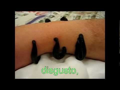 Cura di chistotet di psoriasi Crema da dermatite atopic al bambino