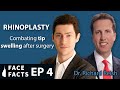 How to Combat Tip Swelling after Rhinoplasty - Dr. Gary Linkov