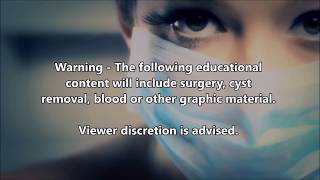 Blackheads, Blackhead & Black Heads Plus Umbilical Cords