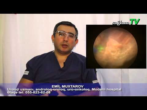 WHO Behandlung von Prostatitis Prostatamassage Foto