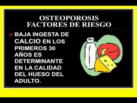 11/08/12 La osteoporosis se está convirtiendo en una de las enfermedades más mortales 11/08/12 La osteoporosis se está convirtiendo en una de las enfermedades más mortales