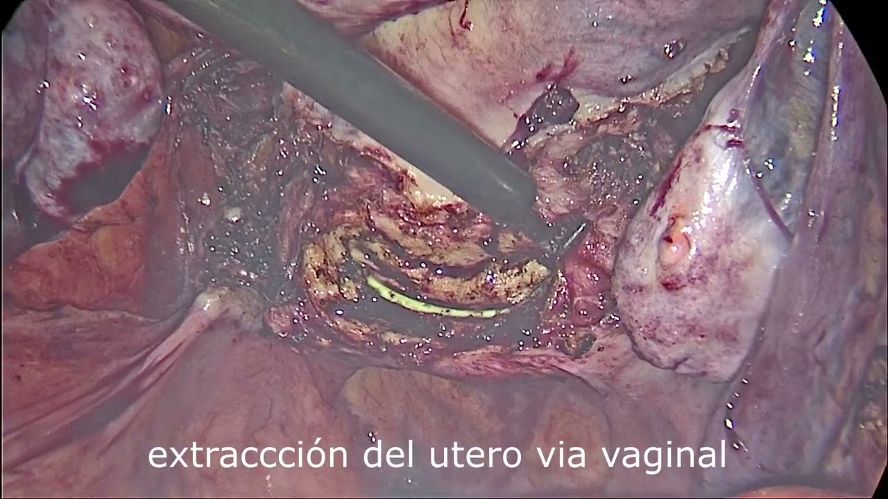 Jorge Alberto Rodriguez Pezino-69