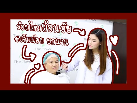 ร้อยไหม หน้าเรียว
