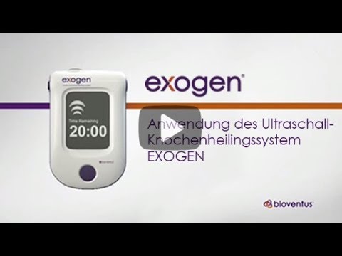 Anwendung von EXOGEN (de)