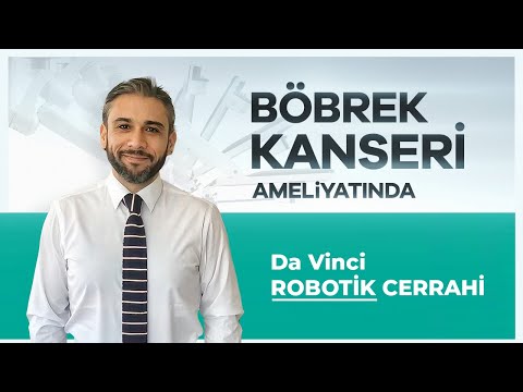 Da Vinci Robotic Surgery Kidney Operations