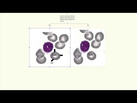 Rh factor, negative-positive. Rh blood type. Rh factor pregnancy.