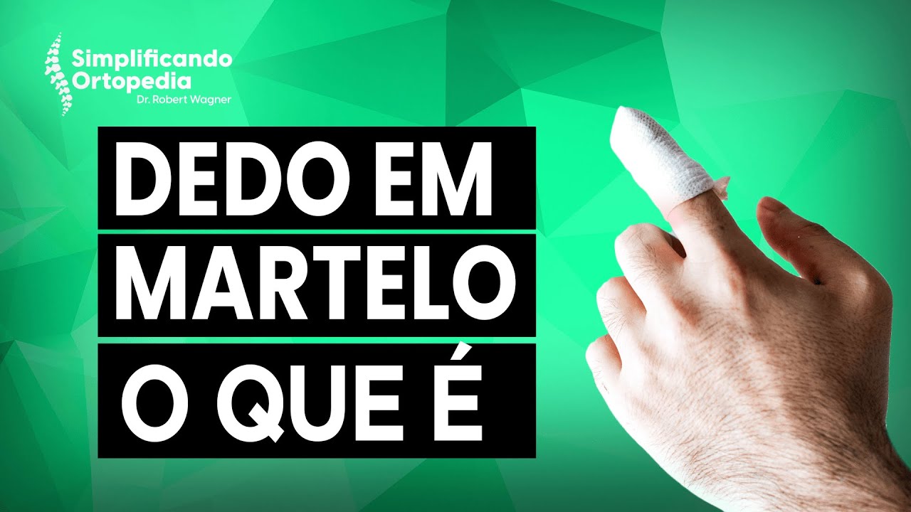 Dedo em Martelo: o que é, e como tratar? | Simplificando Ortopedia