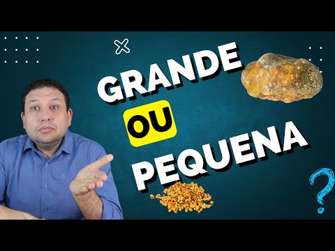 GALLBLADDER STONES. DOES GALLBLADDER SIZE MATTER? DO YOU ALWAYS NEED GALLBLADDER SURGERY?