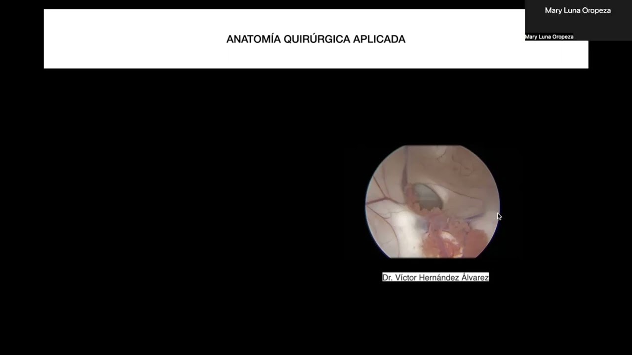 Victor Hernandez Alvarez-6