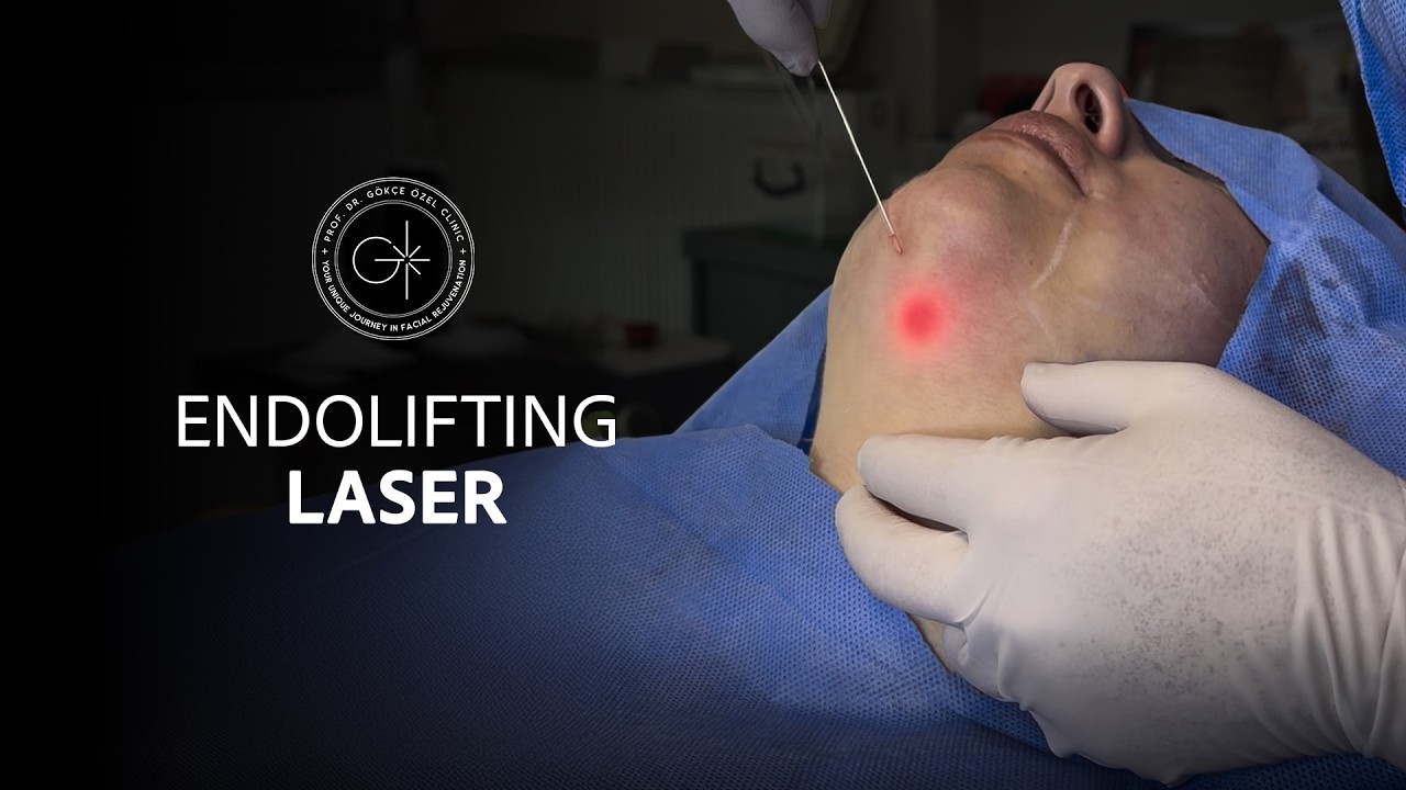 Yüzünüzü Dönüştürün: Lazer Teknolojisi ile Ameliyatsız Çift Çene Giderme #endolift #faciallifting