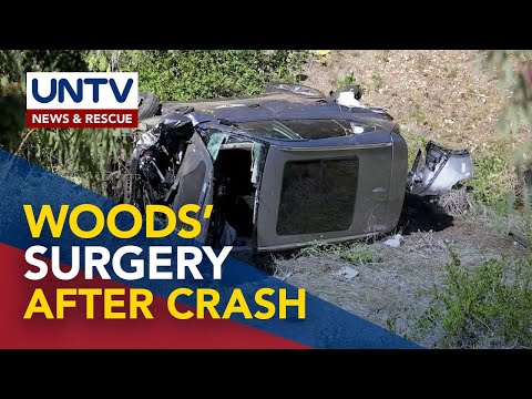 Tiger Woods recovering after multiple leg injuries in car accident
