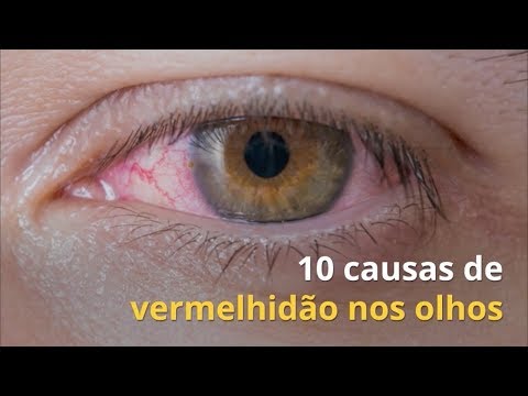 Imagem ilustrativa do vídeo