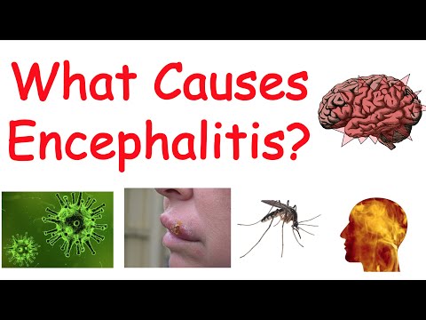 Encephalitis (Brain Inflammation) | Causes, Symptoms, Diagnosis, Treatment