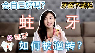 [閒聊] 影片-蛀牙竟然可以自癒?