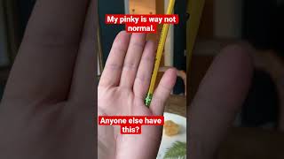 My Crooked Pinky #shorts