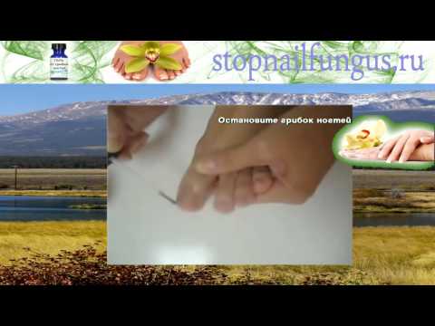 Pagsusuri sa 2016 para sa paggamot ng kuko halamang-singaw sa aking mga paa Kung paano ituring ang candida fungi sa isang paa