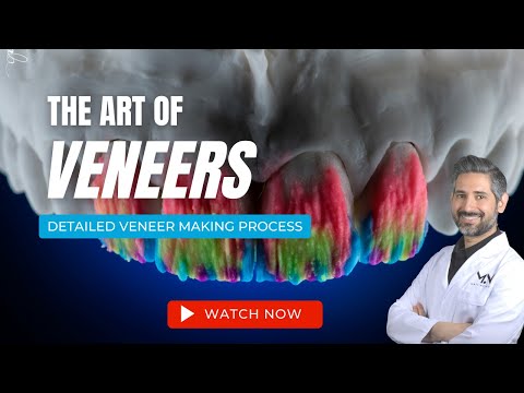 Making Porcelain Veneers 