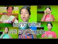 How To Remove My Acne 🫰 Pujaraniswain971 Angul Vlog