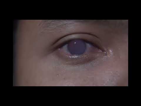 DOKUMENTER PENDIDIKAN ANTI NARKOBA