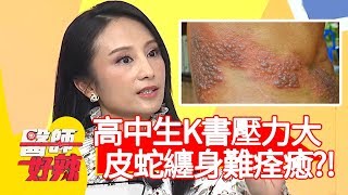 高中生K書壓力大，「皮蛇」纏身難痊癒？！【醫師好辣】20200309 part4 EP906 陳保仁 田知學