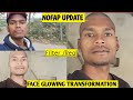 NOFAP UPDATE FACE GLOW TRANSFORMATION JOURNEY Alcoholiyaa8809 Nofaphindi ब्रम्हचर्