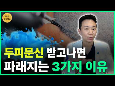 두피문신 색이 변해요? |시술 깊이와 잉크가 중요합니다