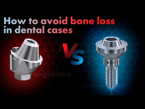 How to avoid bone loss in screw retained restoration? Using dental materials in case