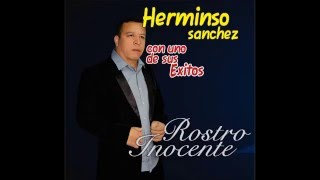 ROSTRO INOCENTE HERMINSON SANCHEZ