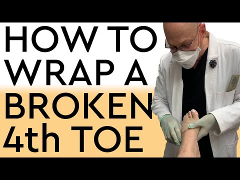 How To Wrap A Broken 4th Toe