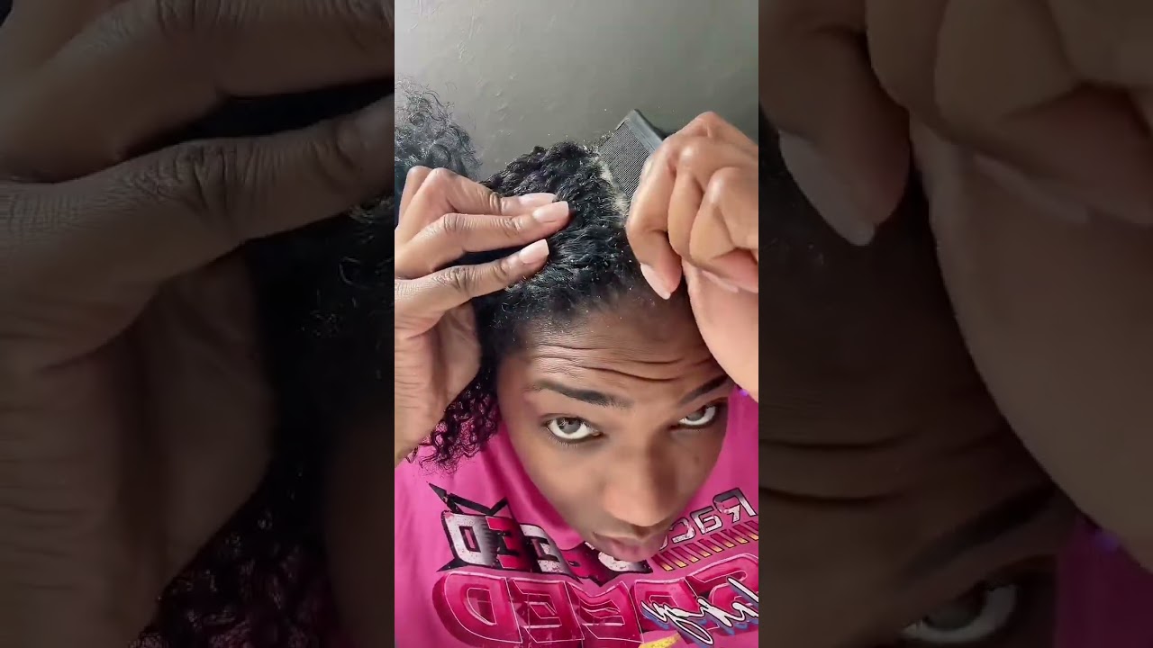 Pellicules sèches ? Voici la solution naturelle 🍃 N’hésitez pas à essayer notre trio naturel 🌿