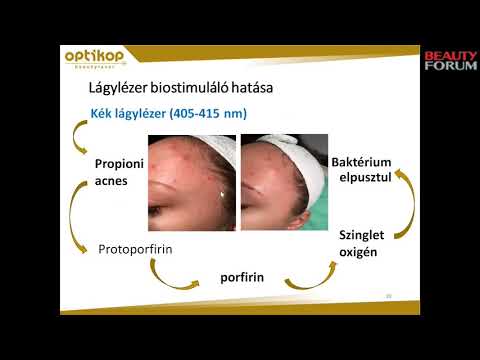 Hogyan kell kezelni a bőr alatti varikózist