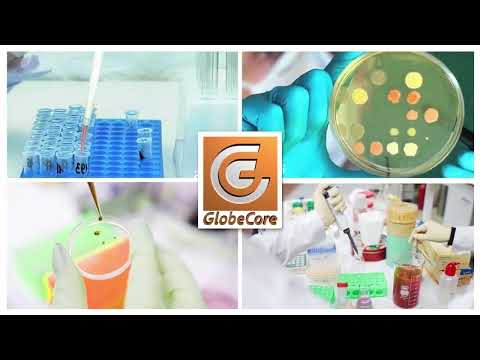 Biodiésel a partir de grasa de pollo con unidad AVS