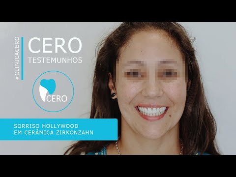 Testemunho Catarina Ribeiro - Sorriso Hollywood em cerâmica Zirkonzahn