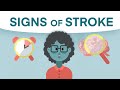 Can You Recognize A Stroke