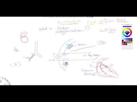 ^MuniSTHealth - #225 How is Cardiac Catheterization Performed?