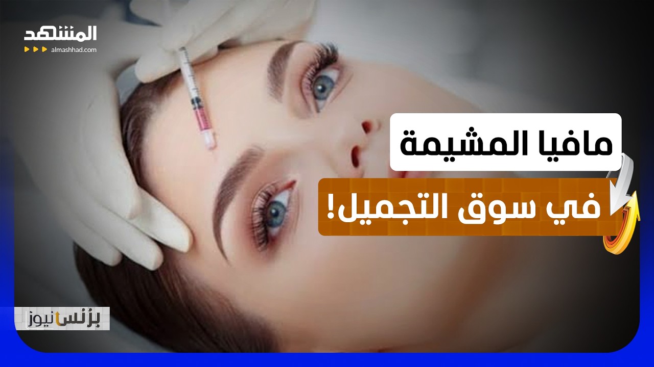 ما علاقة مشيمة الولادة بإبر نضارة البشرة؟ - بزنس نيوز