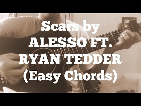 Scars Ft Ryan Tedder - Alesso