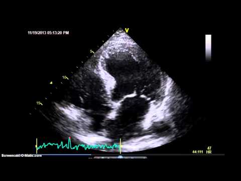 AccreditCoach:  Image Quality   On axis