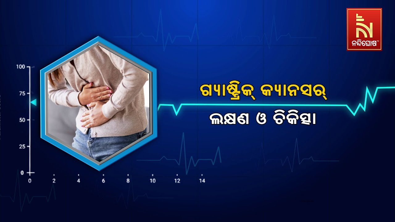 🔴 Live | ଗ୍ୟାଷ୍ଟ୍ରିକ୍ କ୍ୟାନସର୍ :  ଲକ୍ଷଣ ଓ ଚିକିତ୍ସା