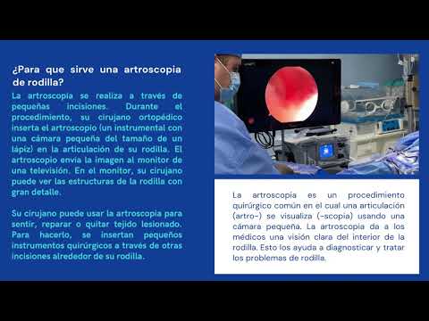 Qué hacer ante un esguince de tobillo