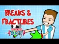 Bone Fractures & Breaks | Operation Ouch