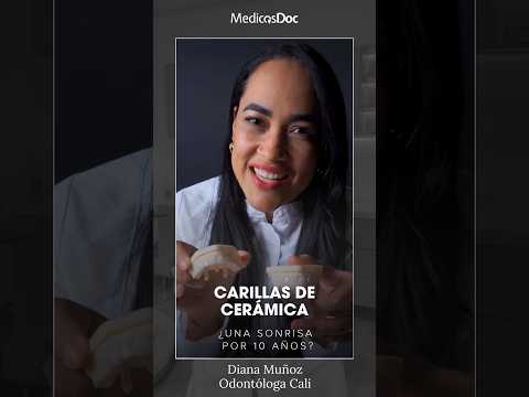 Carillas de cerámica en Cali: ¿cuánto duran? | Dra. Diana Muñoz