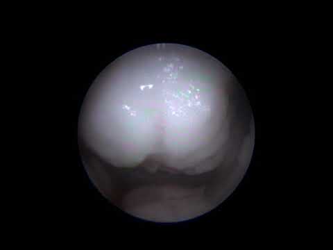 download lagu mp3 mp4 Gynnie, download lagu Gynnie gratis, unduh video klip Gynnie