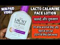Lacto Calamine Face Lotion लैक्टो कैलामाइन लोशन How To Use Lacto