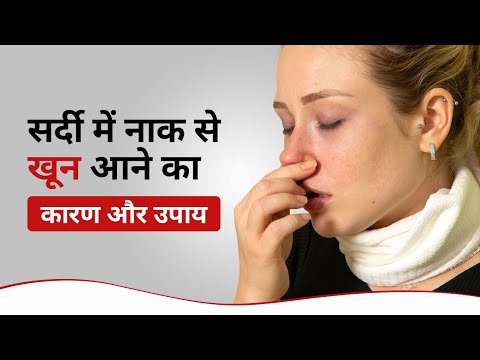 सर्दी जुकाम में नाक से खून आना | Nosebleed in Winter in Hindi | naak se khoon aane ka ilaj